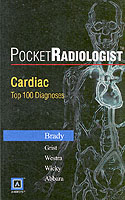 Cardiac Top 100 Diagnoses (Pocketradiologist)