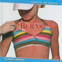 Burns (Head to Toe Health)