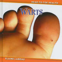 Warts (Head to Toe Health)