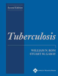 結核疫学（第２版）<br>Tuberculosis (Tuberculosis) （2ND）