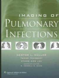 Imaging of Pulmonary Infections