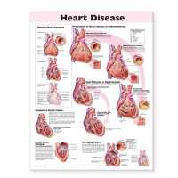 Heart Disease Anatomical Chart （2ND）