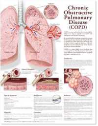 Chronic Obstructive Pulmonary Disease Anatomical Chart （2ND）