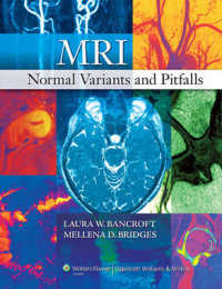 MRI Normal Variants and Pitfalls （1ST）