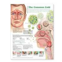 Understanding the Common Cold Anatomical Chart （2ND）