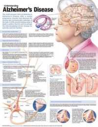 Understanding Alzheimer's Disease Anatomical Chart （2ND）