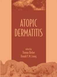 アトピー性皮膚炎<br>Atopic Dermatitis