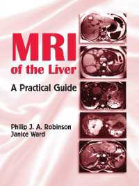 肝臓のＭＲＩ：実用ガイド<br>MRI of the Liver : A Practical Guide