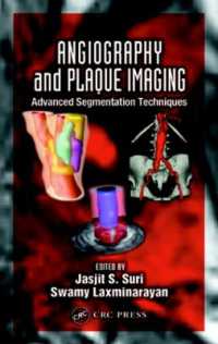 Angiography and Plaque Imaging : Advanced Segmentation Techniques (Biomedical Engineering)