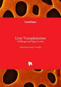 Liver Transplantation : Challenges and Opportunities