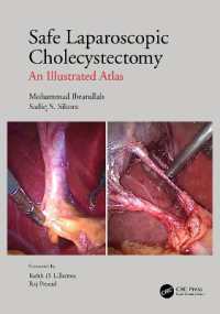 Safe Laparoscopic Cholecystectomy : An Illustrated Atlas