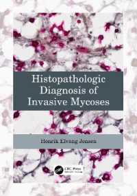 侵襲性真菌症の組織病理診断<br>Histopathologic Diagnosis of Invasive Mycoses