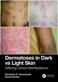 Dermatoses in Dark Vs Light Skin : Differing Clinical Manifestations