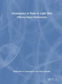 Dermatoses in Dark Vs Light Skin : Differing Clinical Manifestations