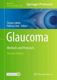 Glaucoma : Methods and Protocols (Methods in Molecular Biology) （2ND）