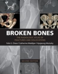 骨折・脱臼アトラス（第２版）<br>Broken Bones : The Radiologic Atlas of Fractures and Dislocations （2ND）