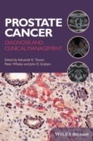 Prostate Cancer : Diagnosis and Clinical Management （1ST）