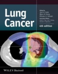 肺癌（第４版）<br>Lung Cancer （4TH）