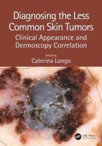 Diagnosing the Less Common Skin Tumors : Clinical Appearance and Dermoscopy Correlation