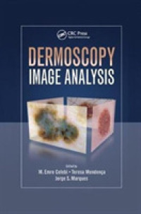 Dermoscopy Image Analysis (Digital Imaging and Computer Vision)