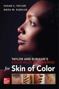 肌の色アトラス・要点<br>Taylor and Elbuluk's Color Atlas and Synopsis for Skin of Color