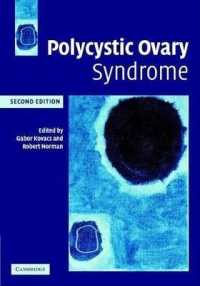 Polycystic Ovary Syndrome （2ND）