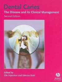 Dental Caries : The Disease and Its Clinical Management （2ND）