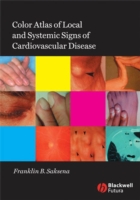 Color Atlas of Local and Systemic Signs of Cardiovascular Disease