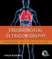 Endobronchial Ultrasonography （1 HAR/DVDR）