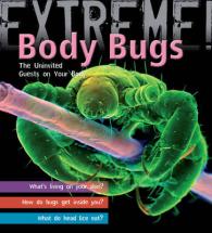 Extreme Science: Body Bugs! : The Uninvited Guests on Your Body (Extreme!)