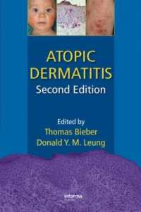 Atopic Dermatitis （2ND）