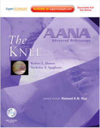 膝：AANA関節鏡先端技術シリーズ<br>AANA Advanced Arthroscopy: the Knee : Expert Consult: Online, Print and DVD (Aana Advanced Arthroscopy)