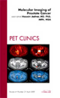 Molecular Imaging of Prostate Cancer, an Issue of PET Clinics (The Clinics: Radiology)