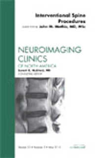 Image-Guided Spine Interventions, an Issue of Neuroimaging Clinics (The Clinics: Radiology)
