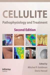 Cellulite : Pathophysiology and Treatment （2ND）