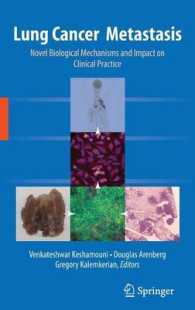 Lung Cancer Metastasis : Novel Biological Mechanisms and Impact on Clinical Practice