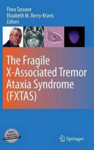 The Fragile X-Associated Tremor Ataxia Syndrome (FXTAS)