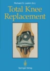 Total Knee Replacement