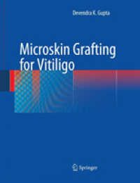 Microskin Grafting for Vitiligo