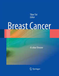 Breast Cancer : A Lobar Disease