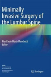Minimally Invasive Surgery of the Lumbar Spine