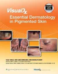 VisualDx皮膚色素性疾患<br>VisualDx: Essential Dermatology in Pigmented Skin (Visualdx: the Modern Library of Visual Medicine)