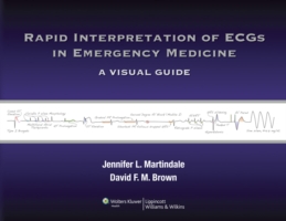 Rapid Interpretation of ECGs in Emergency Medicine : A Visual Guide （1ST）