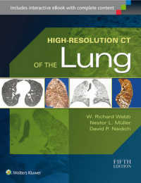 肺の高解像度ＣＴ（第５版）<br>High-Resolution CT of the Lung （5 HAR/PSC）
