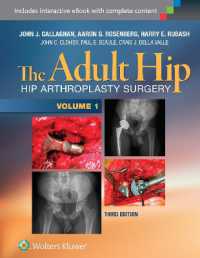 成人の股関節（第３版・全２巻）<br>The Adult Hip (Two Volume Set) : Hip Arthroplasty Surgery （3RD）