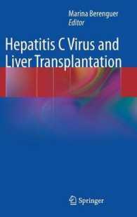 Hepatitis C Virus and Liver Transplantation （2014）