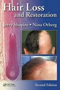 Hair Loss and Restoration （2ND）