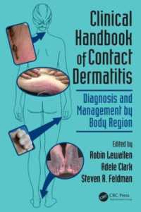 接触皮膚炎：臨床ハンドブック<br>Clinical Handbook of Contact Dermatitis : Diagnosis and Management by Body Region