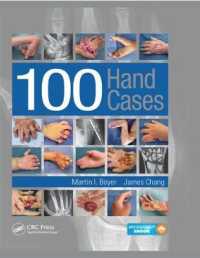 100 Hand Cases （1 HAR/PSC）