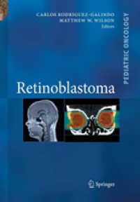 Retinoblastoma (Pediatric Oncology)